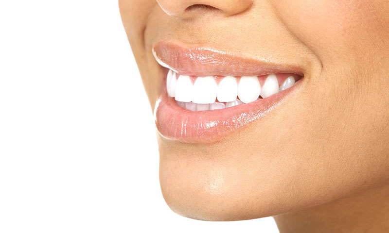 Dental Implants white woman teeth