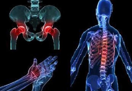 Osteoporosis problem for human bones and how to prevent it