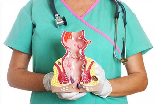 Hemorrhoids: Rectal Pain - A Common Condition