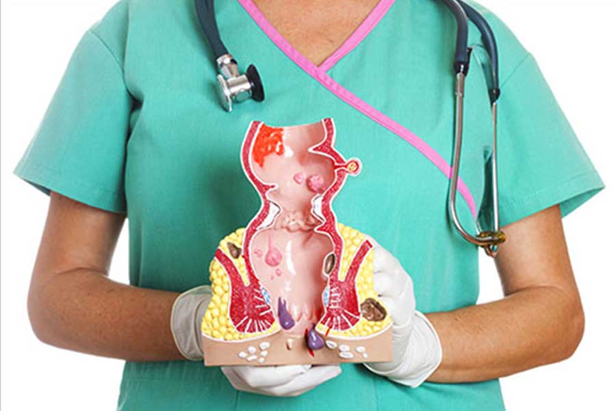 Hemorrhoids: Rectal Pain - A Common Condition