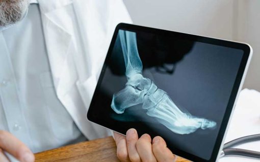 Does Your Ankle Hurt While Sitting? Here Are Some Causes