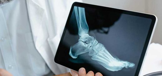Does Your Ankle Hurt While Sitting? Here Are Some Causes